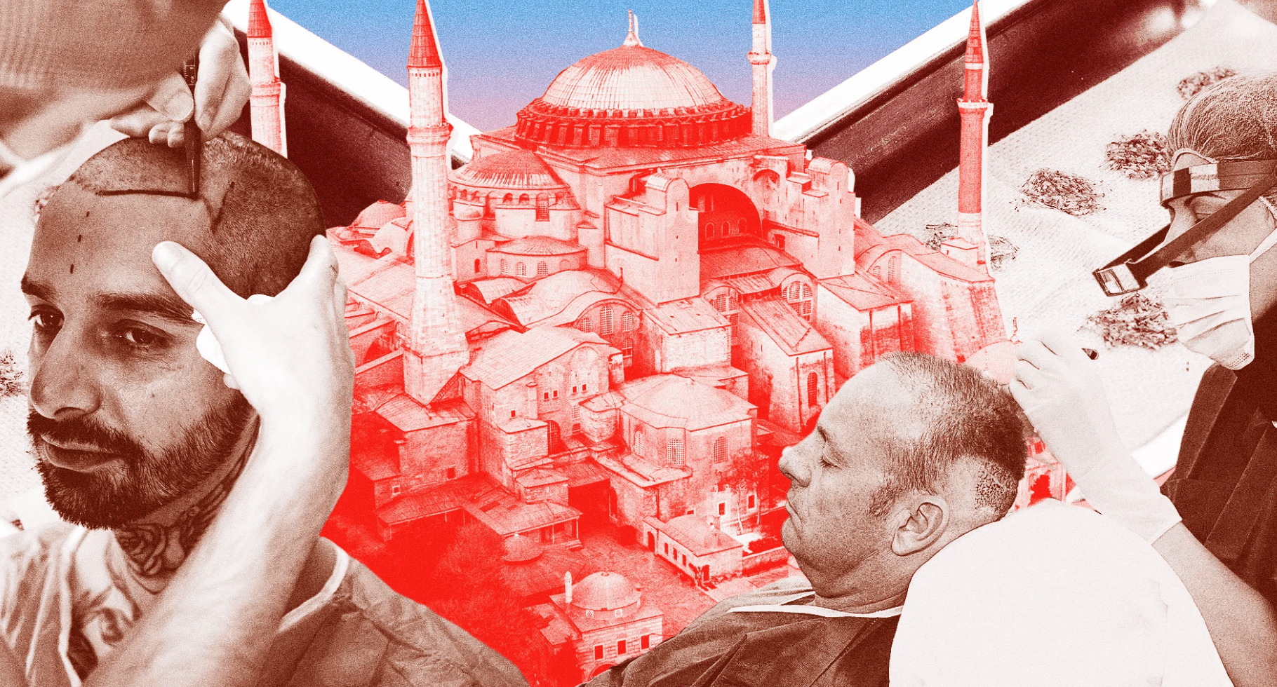 Healthcare Tourism in Turkey: Turkish Hairlines is Number One